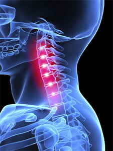 neck-pain-1