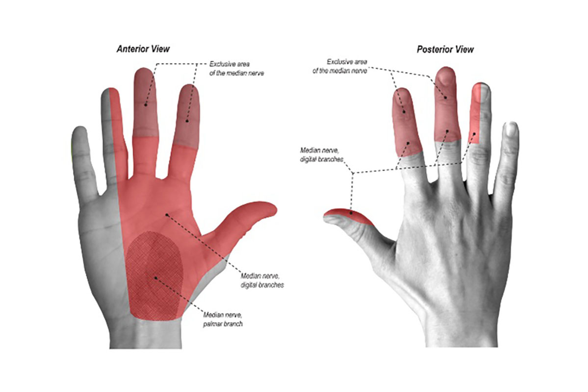 Carpal Tunnel 1